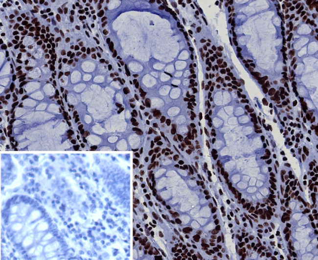 BRG1/SMARCA4 Antibody in Immunohistochemistry (Paraffin) (IHC (P))