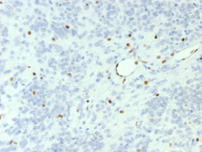 BRG1/SMARCA4 Antibody in Immunohistochemistry (Paraffin) (IHC (P))