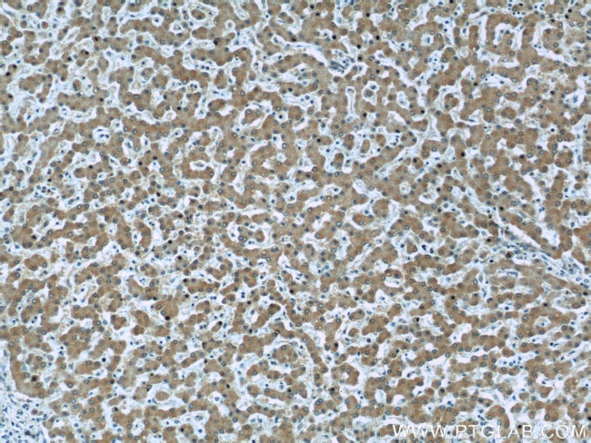 Caspase 8 Antibody in Immunohistochemistry (Paraffin) (IHC (P))