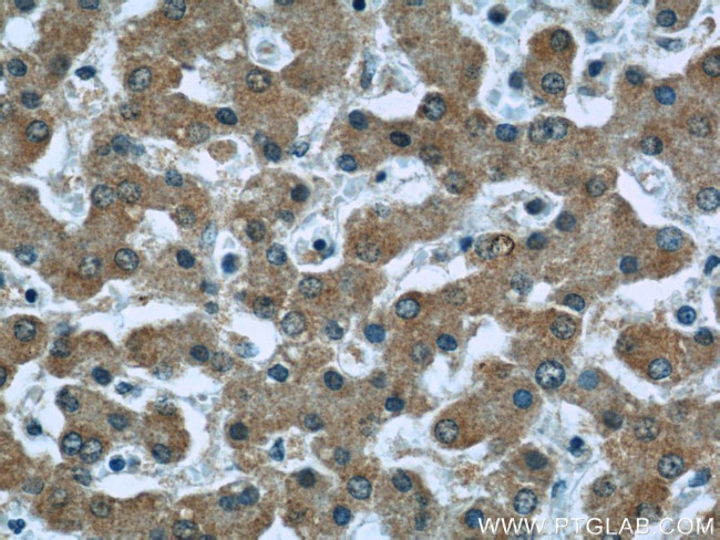 Caspase 8 Antibody in Immunohistochemistry (Paraffin) (IHC (P))