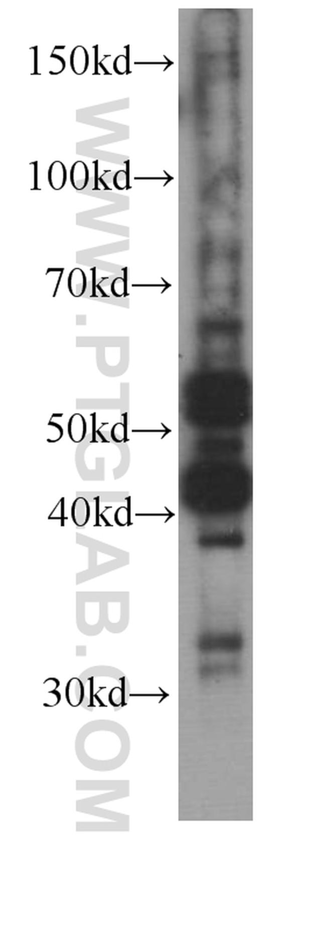 Caspase 8 Antibody in Western Blot (WB)