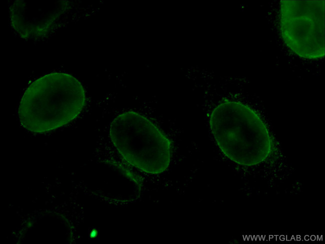 Lamin B1 Antibody in Immunocytochemistry (ICC/IF)