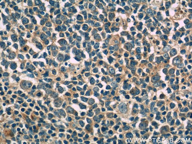 IL-4 Antibody in Immunohistochemistry (Paraffin) (IHC (P))