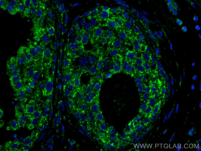 IL-4 Antibody in Immunohistochemistry (PFA fixed) (IHC (PFA))