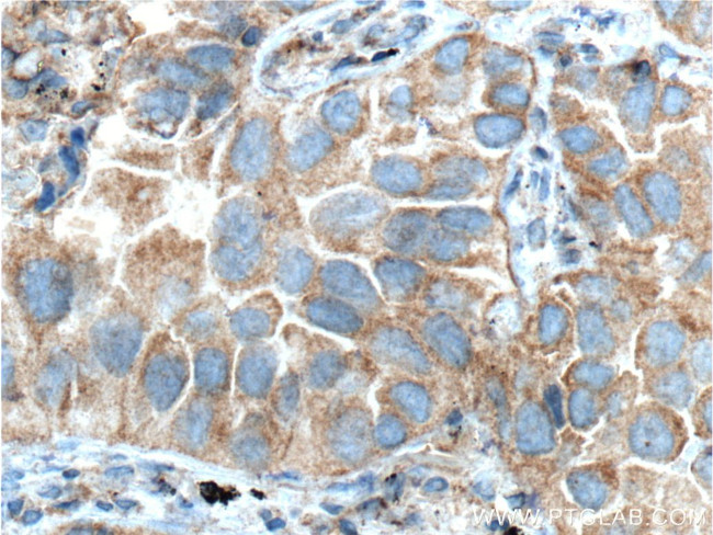 IL22RA2 Antibody in Immunohistochemistry (Paraffin) (IHC (P))