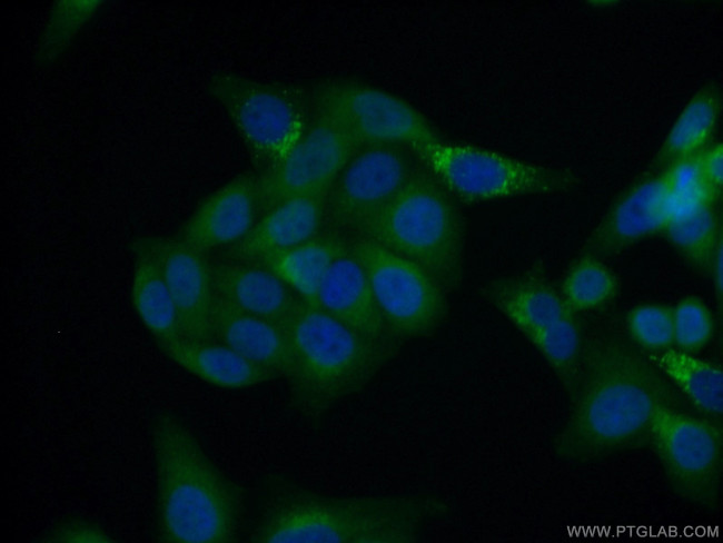 STXBP2 Antibody in Immunocytochemistry (ICC/IF)