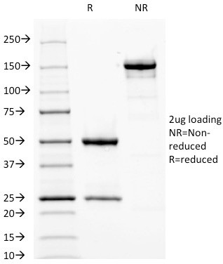 Fascin-1 (Reed-Sternberg Cell Marker) Antibody in SDS-PAGE (SDS-PAGE)