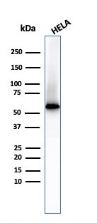 Fascin-1 (Reed-Sternberg Cell Marker) Antibody in Western Blot (WB)