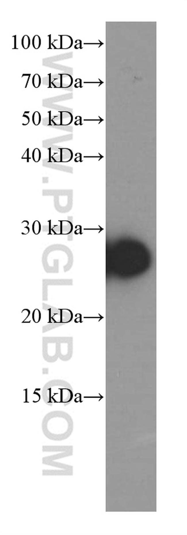 Dermatopontin Antibody in Western Blot (WB)