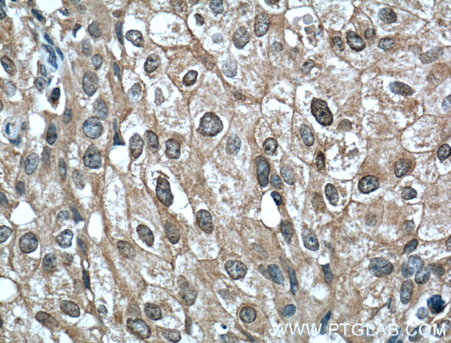 Phospho-AKT (Ser473) Antibody in Immunohistochemistry (Paraffin) (IHC (P))