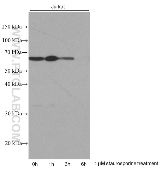 Phospho-AKT (Ser473) Antibody in Western Blot (WB)