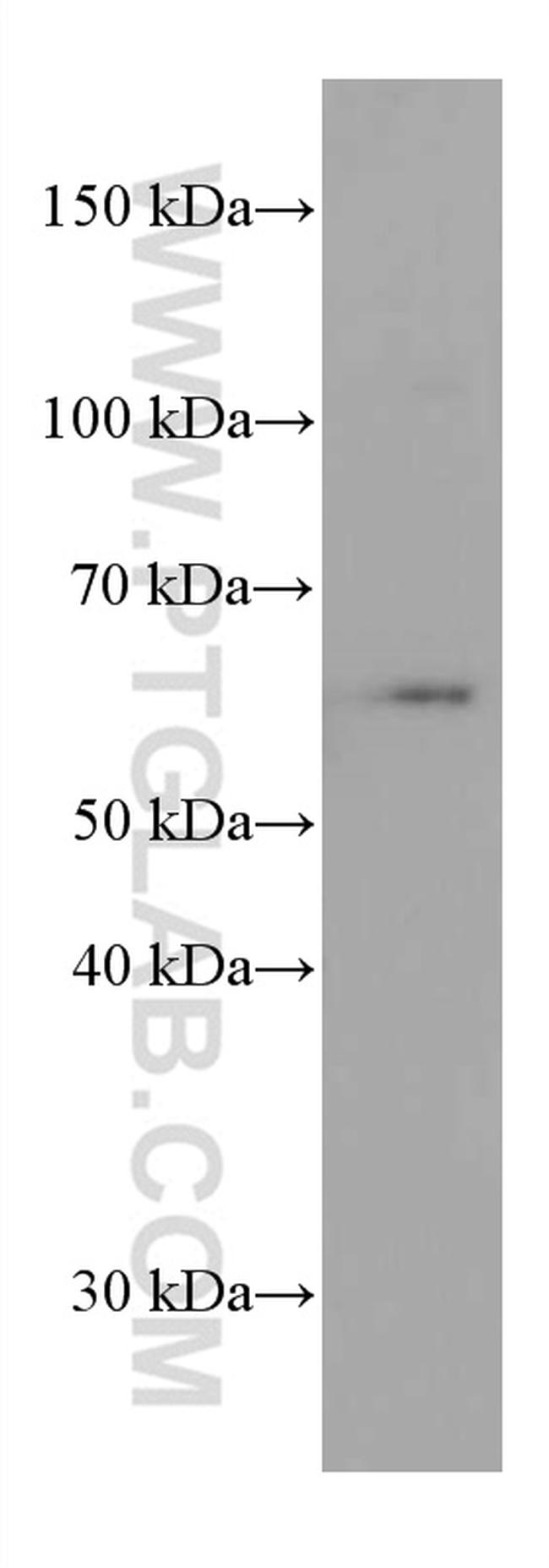 Phospho-AKT (Ser473) Antibody in Western Blot (WB)