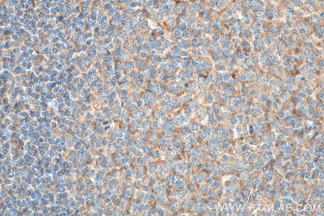 Lysozyme Antibody in Immunohistochemistry (Paraffin) (IHC (P))