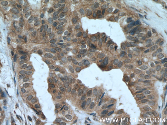 JAK1 Antibody in Immunohistochemistry (Paraffin) (IHC (P))