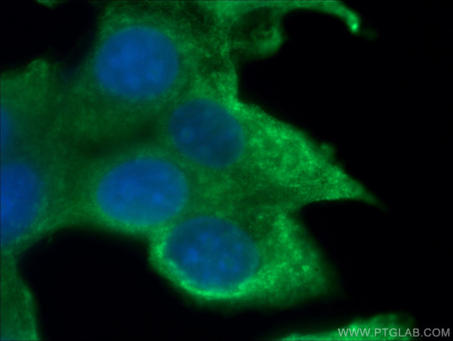 NRG1 Antibody in Immunocytochemistry (ICC/IF)