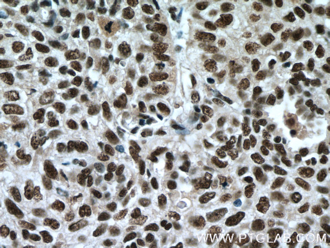 SP1 Antibody in Immunohistochemistry (Paraffin) (IHC (P))