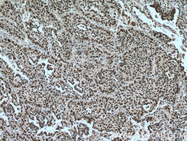 SP1 Antibody in Immunohistochemistry (Paraffin) (IHC (P))