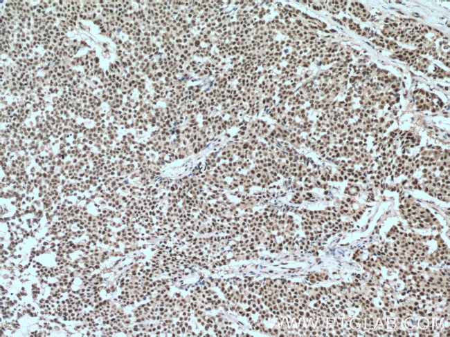 SP1 Antibody in Immunohistochemistry (Paraffin) (IHC (P))