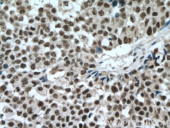 SP1 Antibody in Immunohistochemistry (Paraffin) (IHC (P))