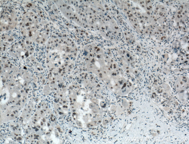 HMGB1 Antibody in Immunohistochemistry (Paraffin) (IHC (P))