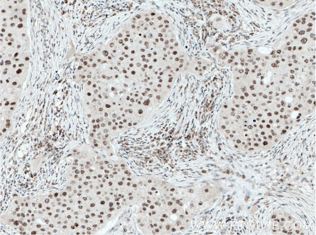 HMGB1 Antibody in Immunohistochemistry (Paraffin) (IHC (P))