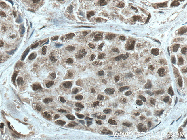 HMGB1 Antibody in Immunohistochemistry (Paraffin) (IHC (P))