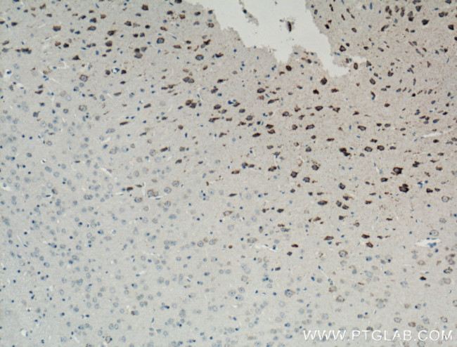 ARC Antibody in Immunohistochemistry (Paraffin) (IHC (P))