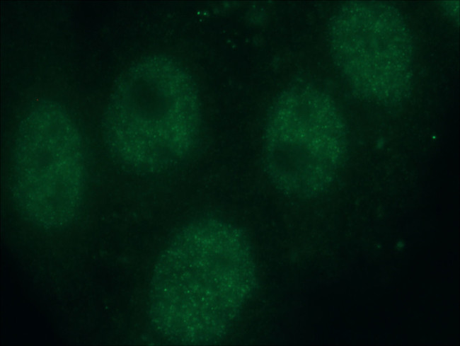 SMARCA4 Antibody in Immunocytochemistry (ICC/IF)