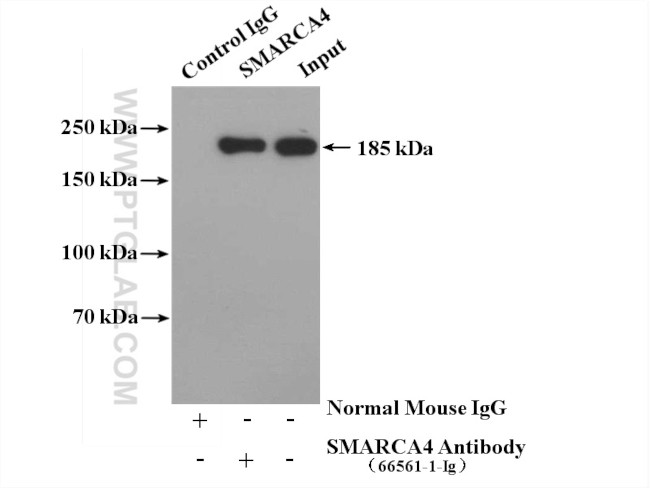 SMARCA4 Antibody in Immunoprecipitation (IP)
