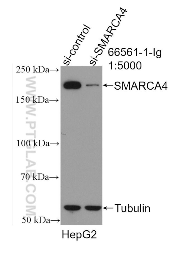 SMARCA4 Antibody in Western Blot (WB)