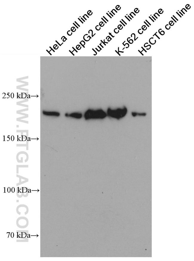 SMARCA4 Antibody in Western Blot (WB)