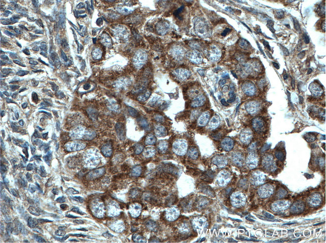 CHCHD5 Antibody in Immunohistochemistry (Paraffin) (IHC (P))