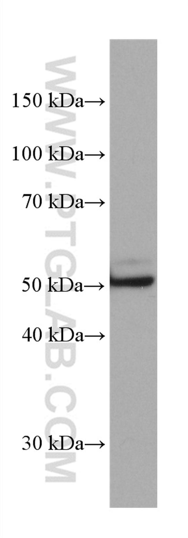 ETS1 Antibody in Western Blot (WB)