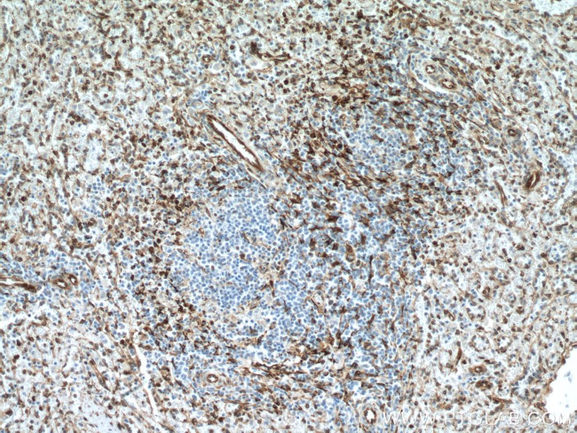 TMEM173/STING Antibody in Immunohistochemistry (Paraffin) (IHC (P))