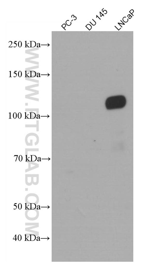 AR Antibody in Western Blot (WB)