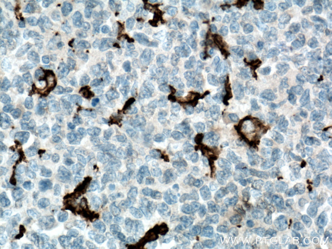 IBA1 Antibody in Immunohistochemistry (Paraffin) (IHC (P))