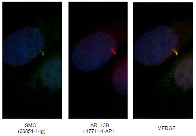 SMO Antibody in Immunocytochemistry (ICC/IF)