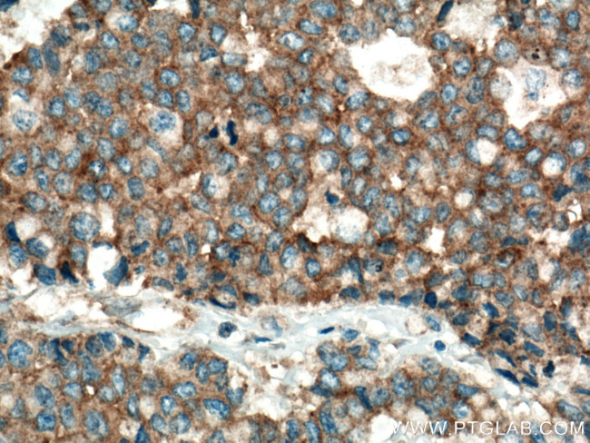 mTOR Antibody in Immunohistochemistry (Paraffin) (IHC (P))