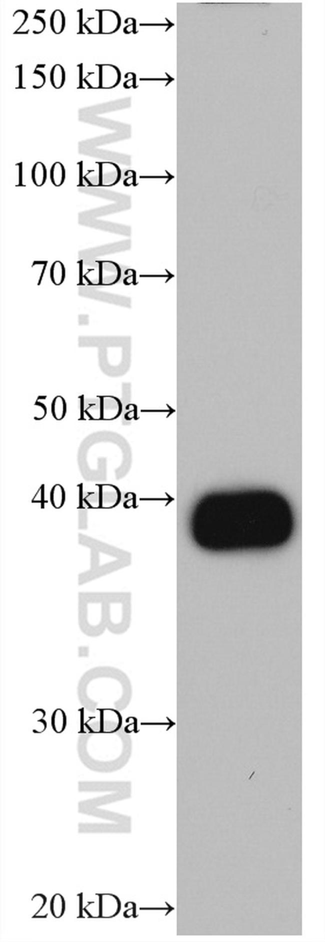 CA6 Antibody in Western Blot (WB)