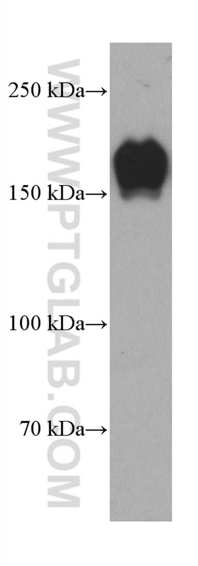 PARD3 Antibody in Western Blot (WB)