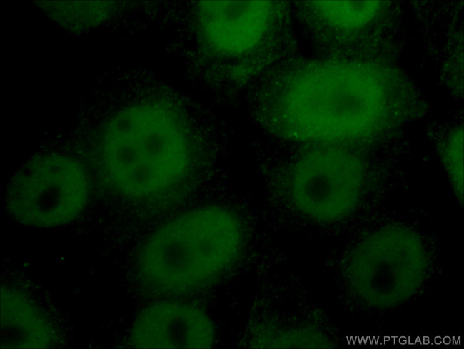 CTBP1 Antibody in Immunocytochemistry (ICC/IF)