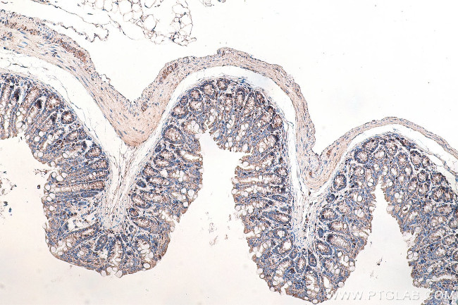 DVL2 Antibody in Immunohistochemistry (Paraffin) (IHC (P))