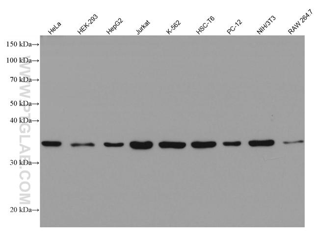 AMPK Gamma 1 Antibody in Western Blot (WB)