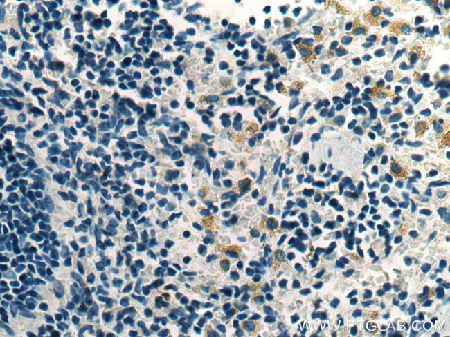 UNC13D Antibody in Immunohistochemistry (Paraffin) (IHC (P))