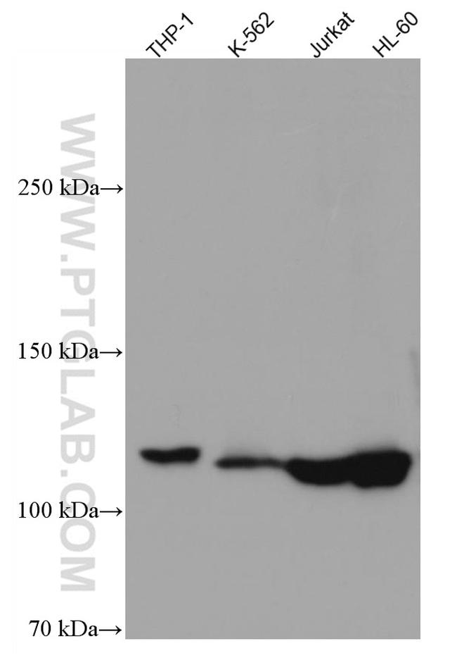UNC13D Antibody in Western Blot (WB)