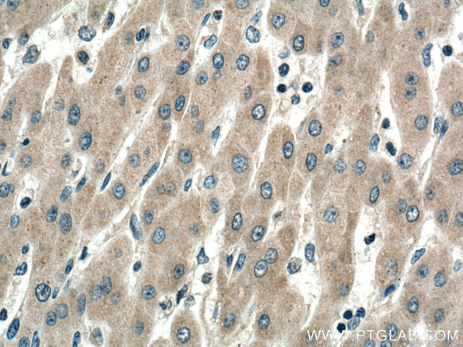 SIRT5 Antibody in Immunohistochemistry (Paraffin) (IHC (P))