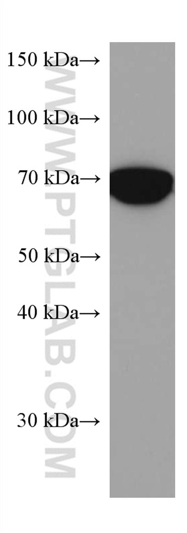 PTGS1 Antibody in Western Blot (WB)