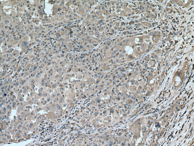 Caspase 4 Antibody in Immunohistochemistry (Paraffin) (IHC (P))