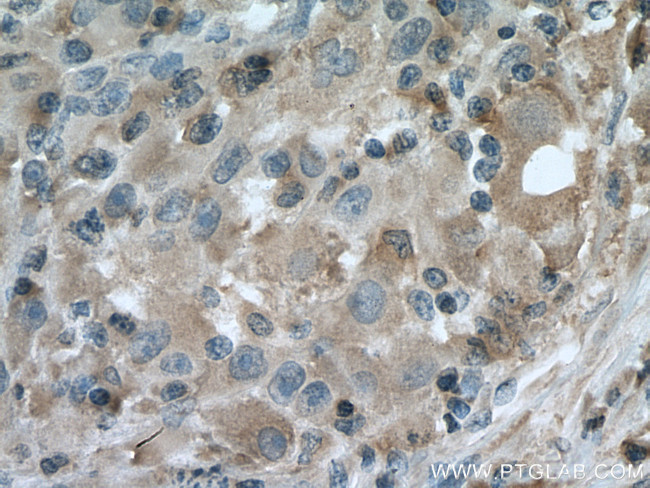 Caspase 4 Antibody in Immunohistochemistry (Paraffin) (IHC (P))