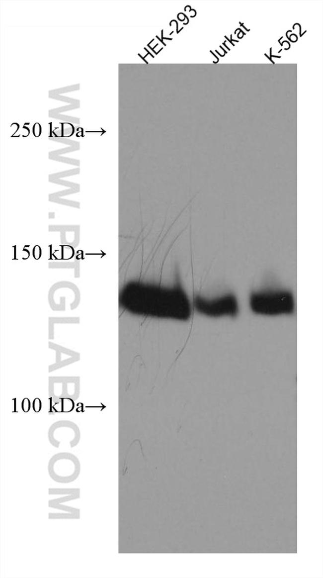 SALL2 Antibody in Western Blot (WB)